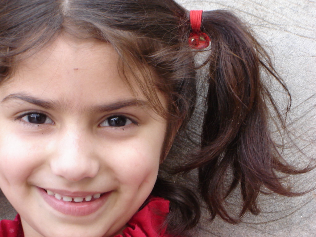 5 Ways To Get Rid Of White Spots On The Face Of Your Child 5 Ways To Get Rid Of White Spots On The Face Of Your Child